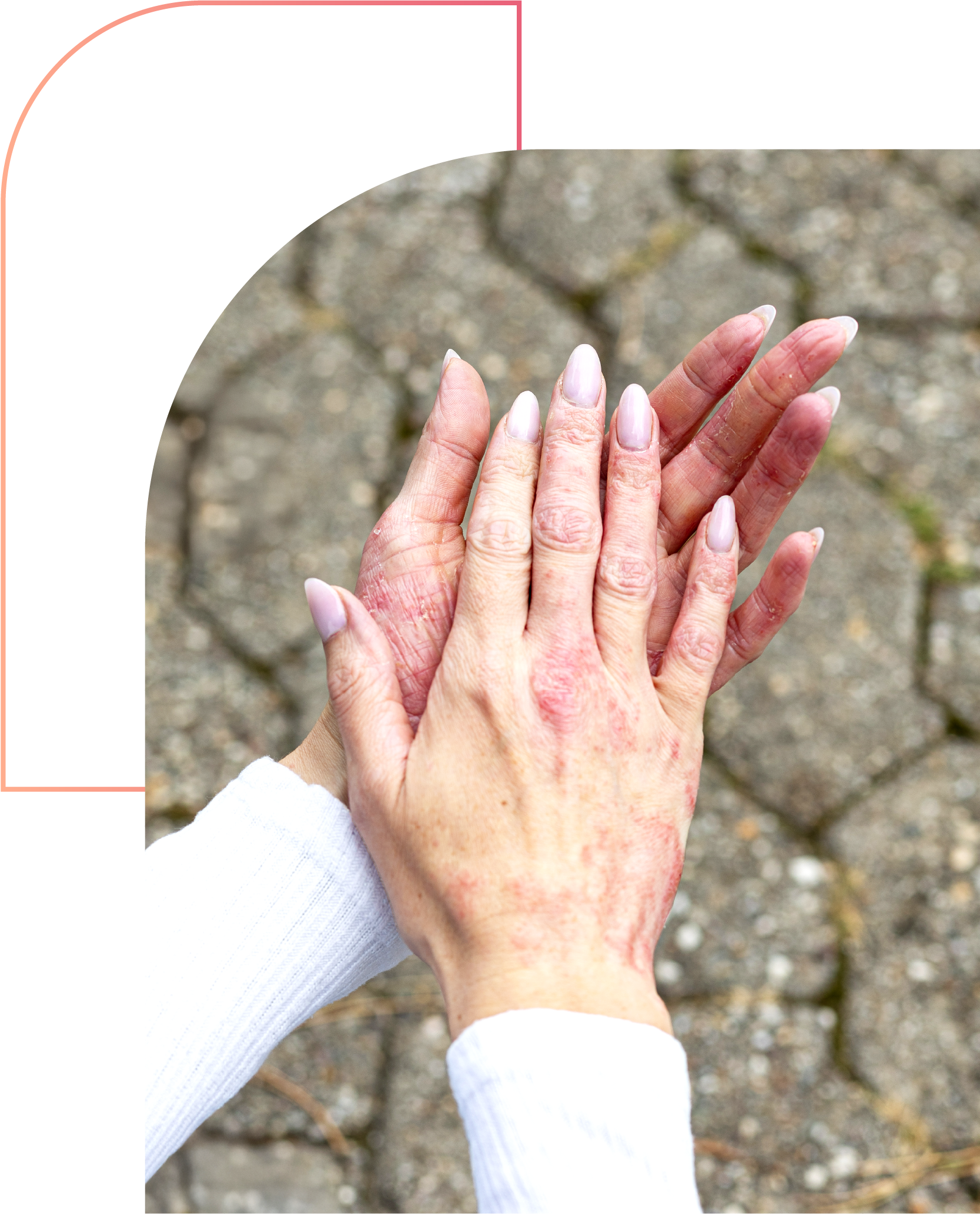 Advanced Care for Dry and Damaged Skin